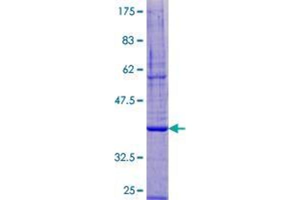 DPM3 Protein (AA 1-122) (GST tag)