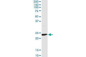 Immunoprecipitation of UBE2T transfected lysate using anti-UBE2T monoclonal antibody and Protein A Magnetic Bead , and immunoblotted with UBE2T MaxPab rabbit polyclonal antibody. (Ube2t 抗体  (AA 1-197))