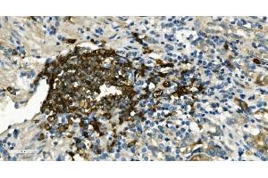 IHC analysis of CD20/MS4A1 using anti-CD20/MS4A1 antibody (ABIN7599233).