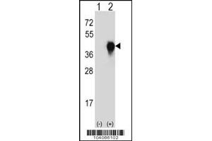 Western blot analysis of PLAUR using rabbit polyclonal PLAUR Antibody (W151) using 293 cell lysates (2 ug/lane) either nontransfected (Lane 1) or transiently transfected (Lane 2) with the PLAUR gene. (PLAU 抗体  (AA 136-166))