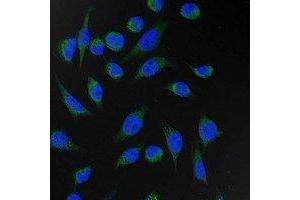 Immunofluorescent analysis of Fumarase staining in Hela cells. (FH 抗体)