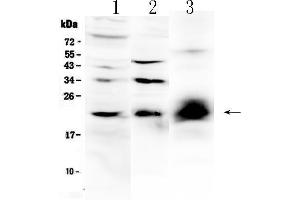 Western blot analysis of IL-22 using anti-IL-22 antibody . (IL-22 抗体  (AA 34-179))