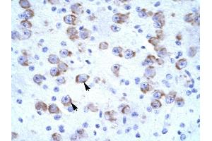 CATSPER2 antibody was used for immunohistochemistry at a concentration of 4-8 ug/ml to stain Neural cells (arrows) in Human Brain. (CATSPER2 抗体  (N-Term))
