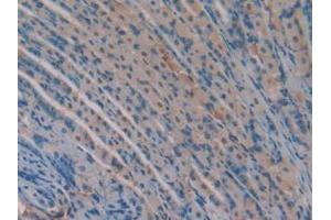 IHC-P analysis of Mouse Stomach Tissue, with DAB staining. (Versican 抗体  (AA 3058-3299))