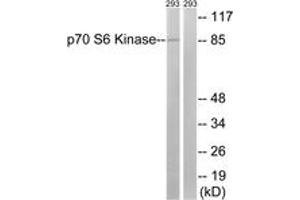 Western blot analysis of extracts from 293 cells, using p70 S6 Kinase (Ab-427) Antibody. (RPS6KB1 抗体  (AA 393-442))