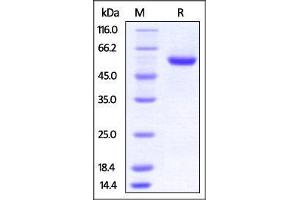 Human ROR2, His Tag on SDS-PAGE under reducing (R) condition. (ROR2 Protein (AA 34-403) (His tag))
