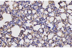 Immunohistochemistry of paraffin-embedded Mouse lung using ANXA5 Polycloanl Antibody at dilution of 1:150 (Annexin V 抗体)