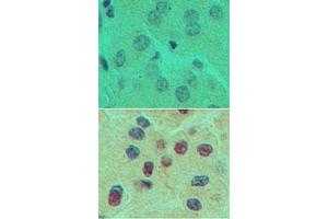 Image no. 1 for anti-One Cut Homeobox 1 (ONECUT1) (AA 420-470) antibody (ABIN960298) (ONECUT1 抗体  (AA 420-470))