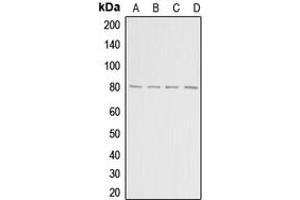 Western blot analysis of ADAR2 expression in HepG2 (A), MCF7 (B), mouse brain (C), rat brain (D) whole cell lysates.