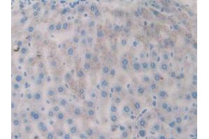 Used in DAB staining on fromalin fixed paraffin- embedded kidney tissue (FLT1 抗体  (AA 303-524))