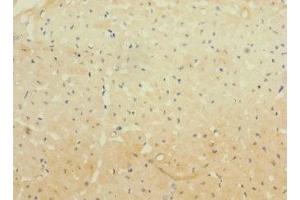 Immunohistochemistry of paraffin-embedded human heart tissue using ABIN7163876 at dilution of 1:100 (WBSCR17 抗体  (AA 101-300))