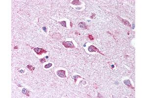 Anti-TLL2 antibody IHC of human brain, neurons and glia. (Tolloid-Like 2 抗体  (CUB2 Domain))