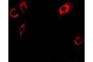 Immunofluorescent analysis of Tropomodulin-4 staining in U2OS cells. (Tropomodulin 4 抗体)