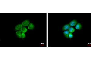 ICC/IF Image HSD3a antibody [N1C2] detects HSD3a protein at cytoplasm and nucleus by immunofluorescent analysis. (AKR1C4 抗体)