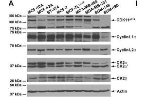Western Blotting (WB) image for anti-Cyclin L2 (CCNL2) (AA 309-384) antibody (ABIN6655712)
