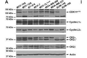 Expression of CDK11 and CK2 protein complex members in untransformed and malignant breast cells. (Cyclin L2 抗体  (AA 309-384))