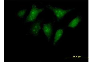 Immunofluorescence of purified MaxPab antibody to RBED1 on HeLa cell. (ELMOD3 抗体  (AA 1-391))