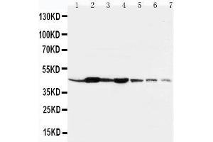 Lane 1: Rat Liver Tissue LysateLane 2: Rat Spleen Tissue LysateLane 3: Rat Brain Tissue LysateLane 4: Rat Kidney Tissue LysateLane 5: HELA Cell LysateLane 6: SMMC Cell LysateLane 7: SGC Cell Lysate (beta Actin 抗体  (N-Term))