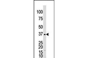 Antibody is used in Western blot to detect GALK1 in Y79 cell lysate. (GALK1 抗体  (C-Term))