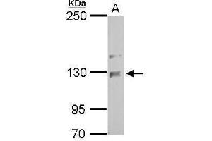 WB Image NCKAP1 antibody [C1C2], Internal detects NCKAP1 protein by Western blot analysis.
