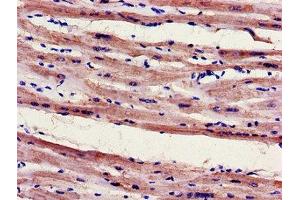 Immunohistochemistry of paraffin-embedded human heart tissue using ABIN7152948 at dilution of 1:100 (FILIP1 抗体  (AA 957-1192))