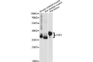 Western blot analysis of extracts of various cell lines, using FBP2 antibody (ABIN6292080) at 1:1000 dilution. (FBP2 抗体)