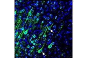 Immunohistochemistry (IHC) image for anti-ATPase, Ca++ Transporting, Plasma Membrane 4 (ATP2B4) (AA 601-617) antibody (ABIN7042958)