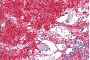 Immunohistochemistry (IHC) image for anti-Guanine Nucleotide Binding Protein (G Protein), alpha Activating Activity Polypeptide O (GNAO1) (Middle Region) antibody (ABIN2786202)