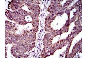 Immunohistochemistry (IHC) image for anti-ATP-Binding Cassette, Sub-Family G (WHITE), Member 5 (ABCG5) (AA 306-367) antibody (ABIN1724857)