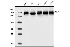 Western blot analysis of BCR using anti-BCR antibody (ABIN7601180).