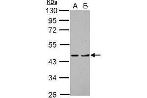 WB Image Sample (30 ug of whole cell lysate) A: H1299 B: HCT116 10% SDS PAGE antibody diluted at 1:1000 (PDCD2 抗体)