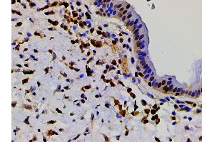Immunohistochemistry (IHC) image for anti-Cofilin 1 (CFL1) (pSer3) antibody (ABIN6255180)