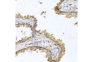 Immunohistochemistry of paraffin-embedded human prostate using RNASE11 antibody (ABIN5970447) at dilution of 1/100 (40x lens). (RNASE11 抗体)