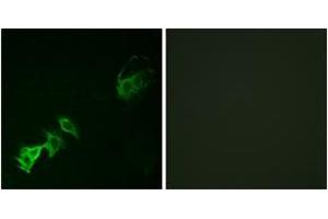 Immunofluorescence analysis of A549 cells, using Abl (Phospho-Tyr393/412) Antibody. (ABL1 抗体  (pTyr393))