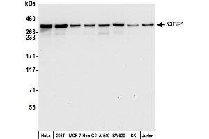 Western Blotting (WB) image for anti-Tumor Protein P53 Binding Protein 1 (TP53BP1) (AA 350-400) antibody (ABIN7455070) (Recombinant TP53BP1 抗体  (AA 350-400))