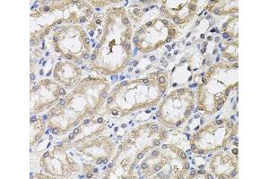 Immunohistochemistry of paraffin-embedded Rat kidney using RNF166 Polyclonal Antibody (RNF166 抗体)