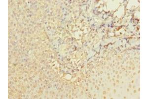 Immunohistochemistry of paraffin-embedded human tonsil tissue using ABIN7142924 at dilution of 1:100 (ABI3 抗体  (AA 1-366))