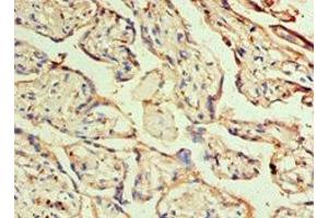 Immunohistochemistry of paraffin-embedded human placenta tissue using ABIN7155678 at dilution of 1:100 (DLX3 抗体  (AA 1-120))