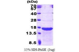 Figure annotation denotes ug of protein loaded and % gel used. (Stathmin-Like 2 (STMN2) (AA 39-179) Peptide)