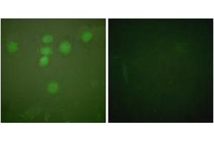 Immunofluorescence analysis of HeLa cells, using CREB (Ab-142) Antibody. (CREB1 抗体  (AA 111-160))