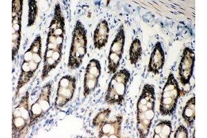 IHC-P: MSH2 antibody testing of rat intestine tissue (MSH2 抗体  (AA 337-583))