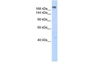 DYSF antibody used at 1 ug/ml to detect target protein. (Dysferlin 抗体)