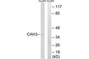 Western blot analysis of extracts from HuvEc cells, using CA3 Antibody. (CA3 抗体  (AA 141-190))