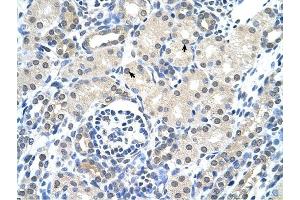 Cytokeratin 17 antibody was used for immunohistochemistry at a concentration of 4-8 ug/ml to stain Epithelial cells of renal tubule (arrows) in Human Kidney. (KRT17 抗体  (C-Term))