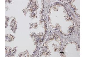 Immunoperoxidase of purified MaxPab antibody to ChGn on formalin-fixed paraffin-embedded human prostate. (CSGALNACT1 抗体  (AA 1-297))