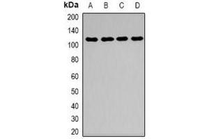 Western blot analysis of Desmoglein 1 expression in HEK293T (A), mouse kidney (B), mouse brain (C), mouse lung (D) whole cell lysates. (Desmoglein 1 抗体  (N-Term))