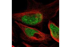 Immunofluorescent staining of human cell line U-2 OS with DACH1 polyclonal antibody  at 1-4 ug/mL dilution shows positivity in nucleus, nucleoli. (DACH1 抗体)