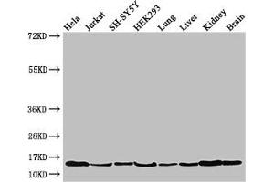 Western Blot Positive WB detected in: Hela whole cell lysate, Jurkat whole cell lysate, SH-SY5Y whole cell lysate, HEK293 whole cell lysate, Mouse lung tissue, Mouse liver tissue, Mouse kidney tissue, Mouse brain tissue All lanes: PAIP2 antibody at 3. (PAIP2 抗体  (AA 1-127))