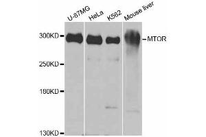 Western blot analysis of extracts of various cell lines, using MTOR antibody. (MTOR 抗体  (AA 2388-2487))