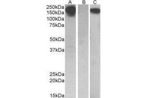 HEK293 lysate (10ug protein in RIPA buffer) overexpressing Human CSF1R with C-terminal MYC tag probed with AP22413PU-N(0. (CSF1R 抗体  (Internal Region))